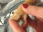 Опухоль между пальцев